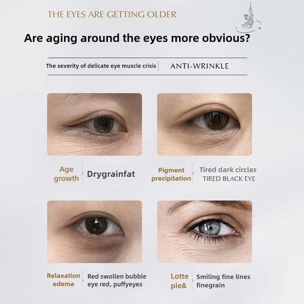 Active-skin-rejuvenation-and-anti-wrinkle-eye-cream-firming-delicate-moisturizing-and-reducing-dark-circles-around.jpg
